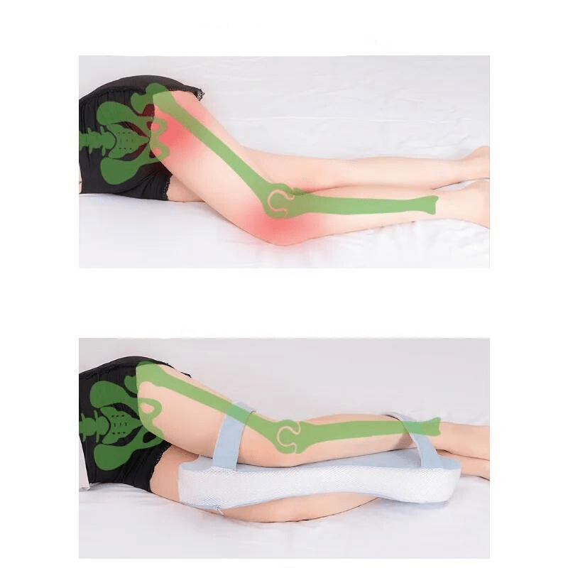 https://cdn.shopify.com/s/files/1/0886/2397/2701/files/Lackofsupportonthighsleadstodistortionofhipjoints.png