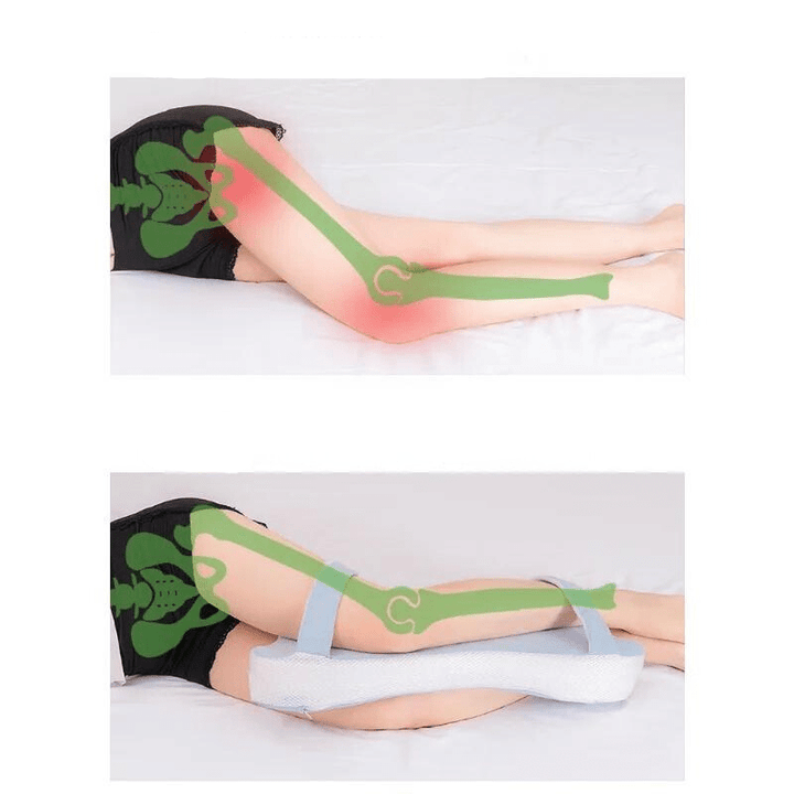 https://cdn.shopify.com/s/files/1/0886/2397/2701/files/Lackofsupportonthighsleadstodistortionofhipjoints.png