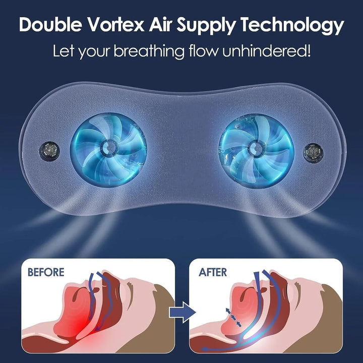 Anti Snoring Device Rechargeable Nasal Insert Fan Plastic Blue White Sleep Aid - Image 6