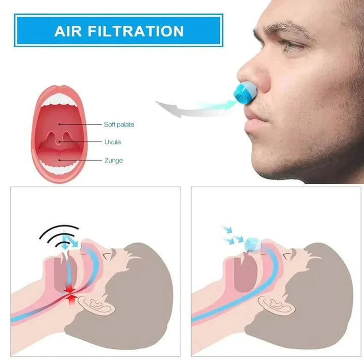 Anti Snoring Device Rechargeable Nasal Insert Fan Plastic Blue White Sleep Aid - Image 8