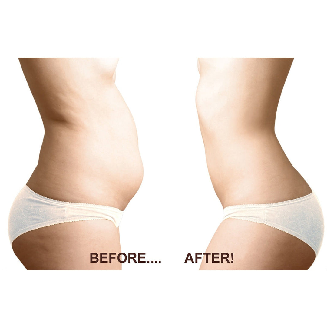 Fat Freezing Device For Non Invasive Reduction With Handheld Cooling Applicator For At Home Body Sculpting - Image 2