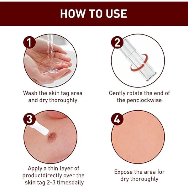 Skin Tag Remover Mole Wart Spot Pen Applicator Clear White Unisex Fast - Image 3