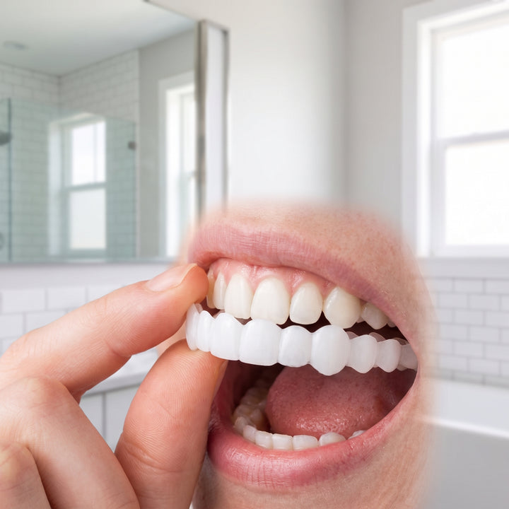 Snap On Veneers Instant Smile Moldable Upper Lower Arch Comfort Fit White - Image 1