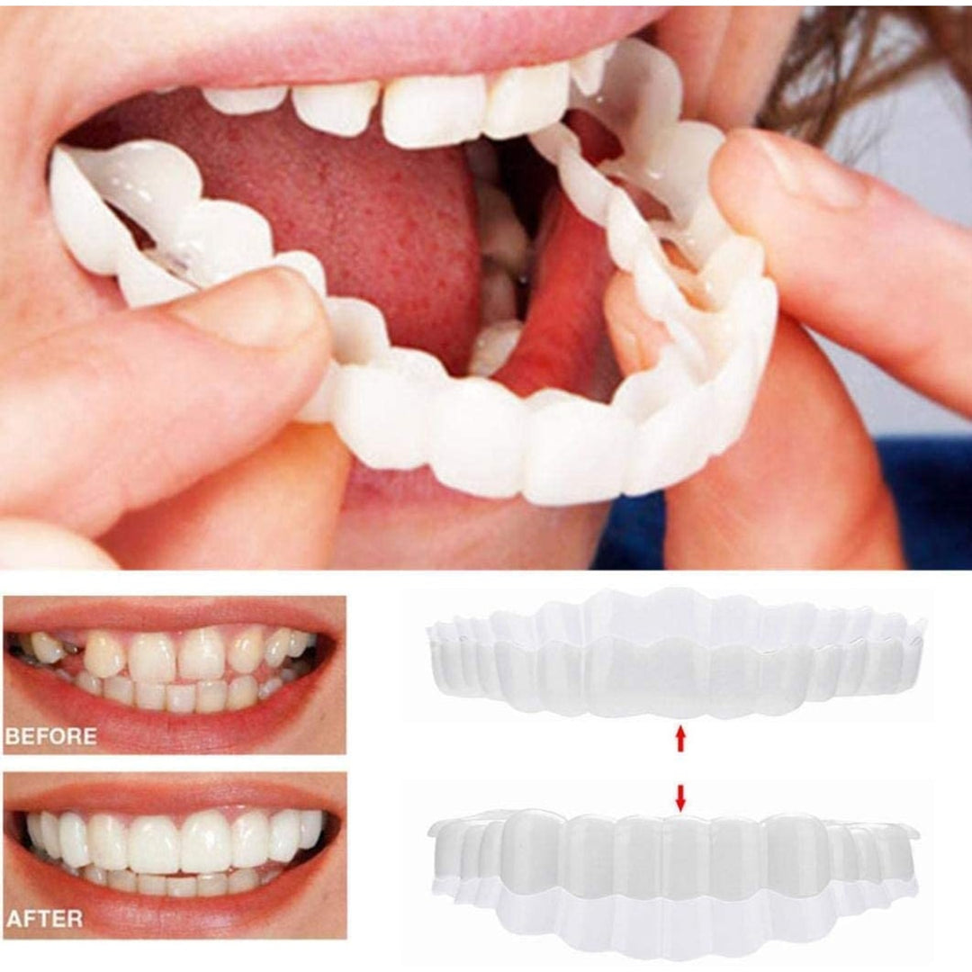Snap On Veneers Instant Smile Moldable Upper Lower Arch Comfort Fit White - Image 9